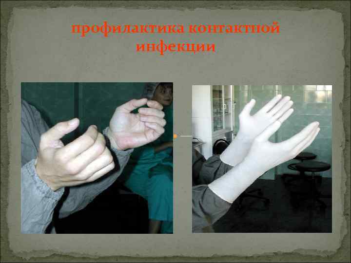 профилактика контактной инфекции 