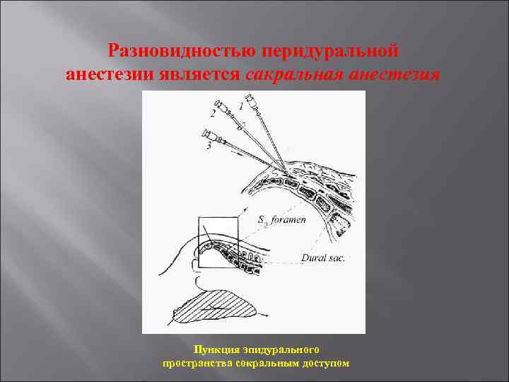 Новокаиновые блокады презентация