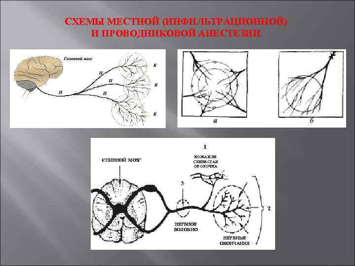 Местная анестезия схема