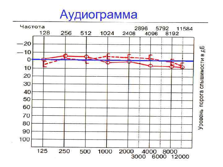 Аудиограмма 