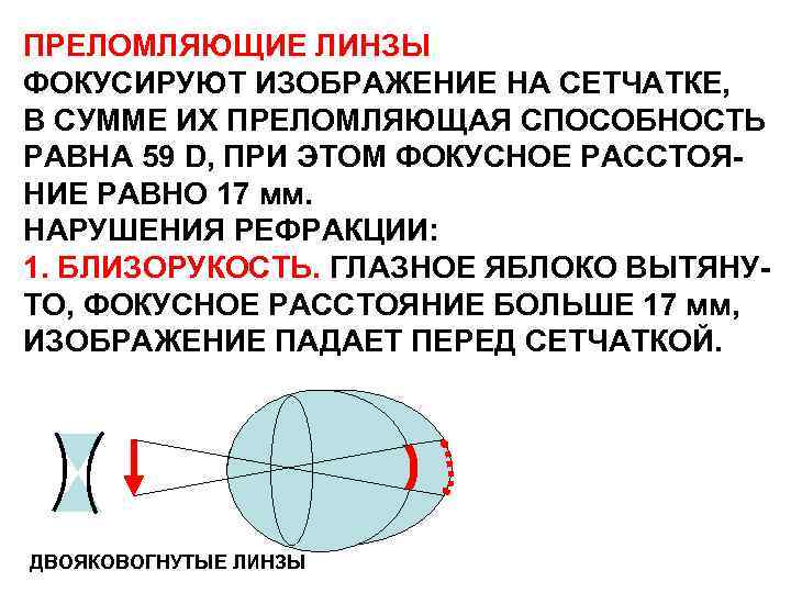 ПРЕЛОМЛЯЮЩИЕ ЛИНЗЫ ФОКУСИРУЮТ ИЗОБРАЖЕНИЕ НА СЕТЧАТКЕ, В СУММЕ ИХ ПРЕЛОМЛЯЮЩАЯ СПОСОБНОСТЬ РАВНА 59 D,