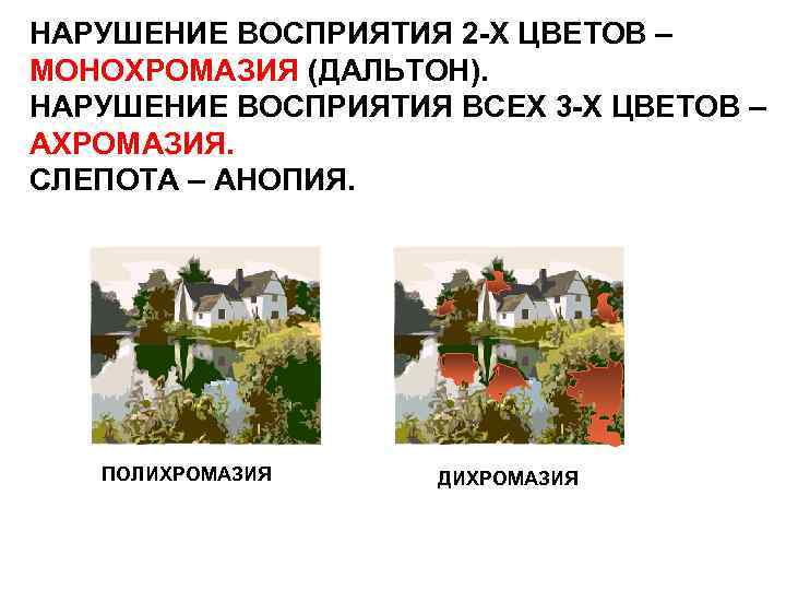 НАРУШЕНИЕ ВОСПРИЯТИЯ 2 -Х ЦВЕТОВ – МОНОХРОМАЗИЯ (ДАЛЬТОН). НАРУШЕНИЕ ВОСПРИЯТИЯ ВСЕХ 3 -Х ЦВЕТОВ