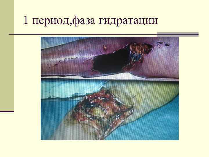 1 период, фаза гидратации 