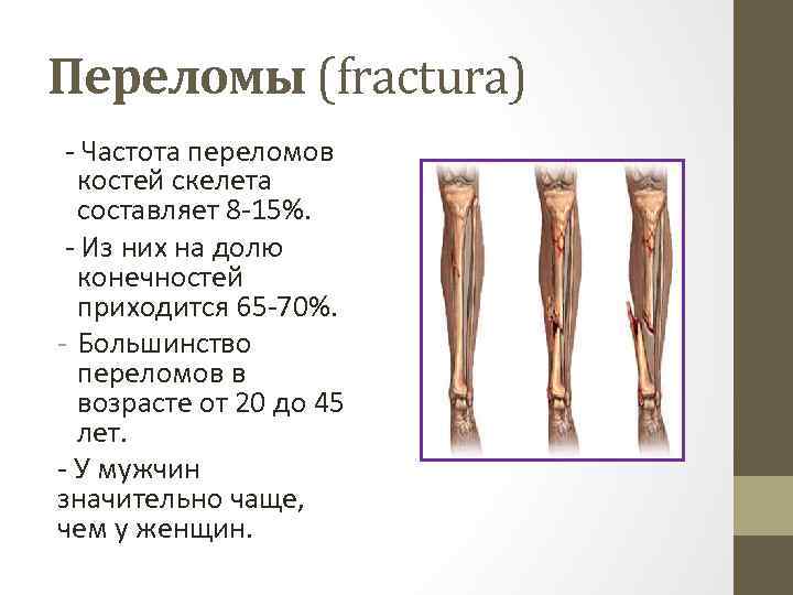 Переломы (fractura) - Частота переломов костей скелета составляет 8 -15%. - Из них на