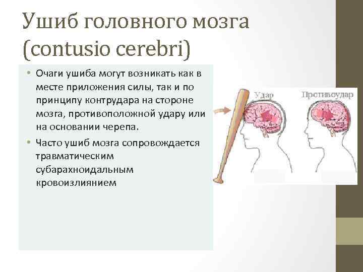 Повреждения головного мозга возникают. Ушиб головного мозга рисунок. Очаг ушиба головного мозга. Ушиб 2 типа головного мозга.
