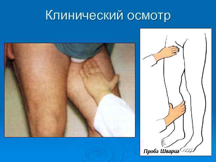 Клинический осмотр 