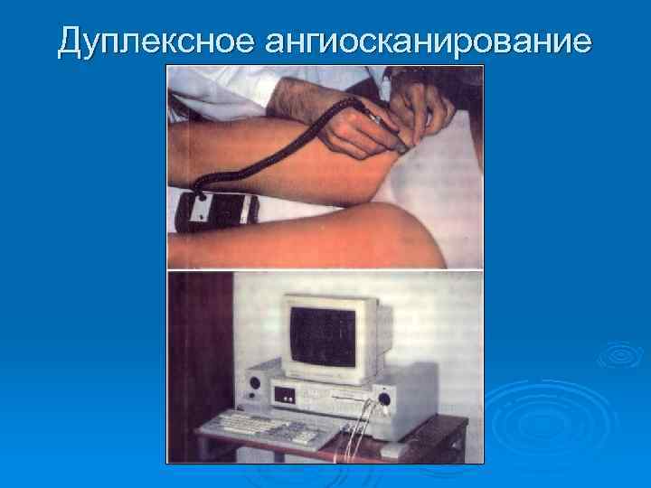 Дуплексное ангиосканирование 