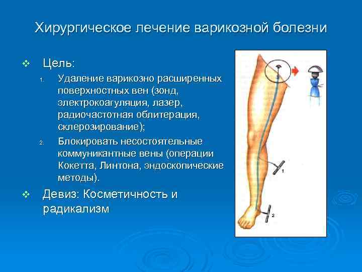 Хирургическое лечение варикозной болезни v Цель: 1. 2. v Удаление варикозно расширенных поверхностных вен