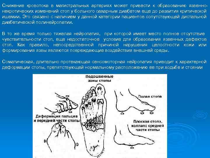Снижение кровотока в магистральных артериях может привести к образованию язвеннонекротических изменений стоп у больного