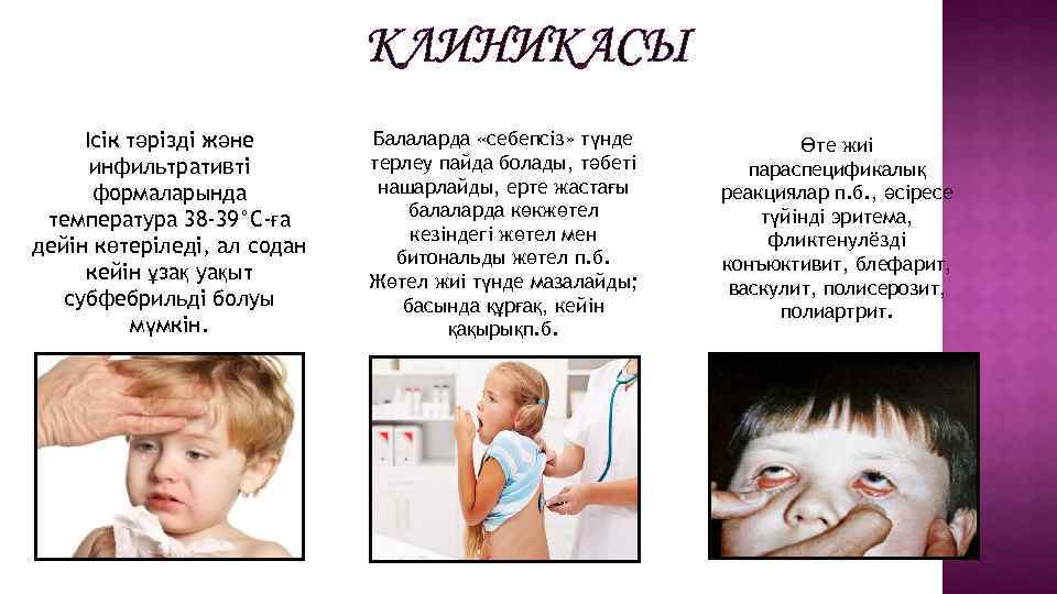 КЛИНИКАСЫ Ісік тәрізді және инфильтративті формаларында температура 38 -39°С-ға дейін көтеріледі, ал содан кейін