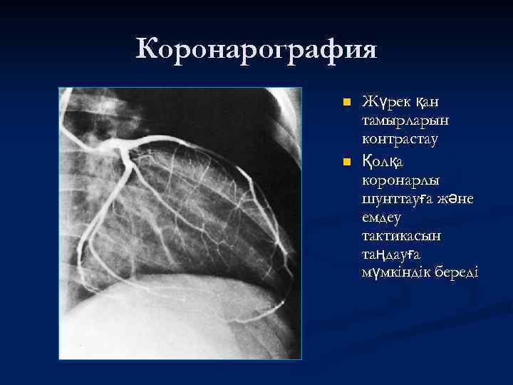 Коронарография n n Жүрек қан тамырларын контрастау Қолқа коронарлы шунттауға және емдеу тактикасын таңдауға
