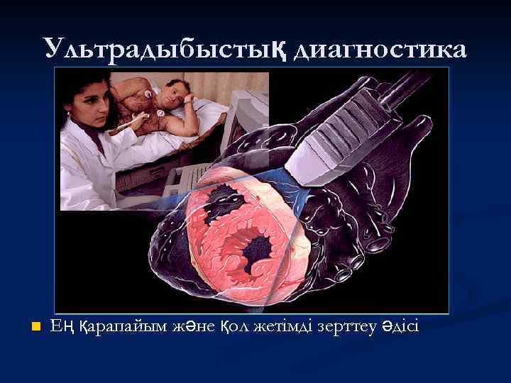 Ультрадыбыстық диагностика n Ең қарапайым және қол жетімді зерттеу әдісі 