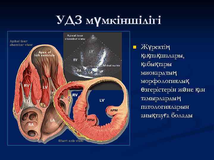 УДЗ мүмкіншілігі n Жүректің қақпақшалары, қабықтары миокардтың морфологиялық өзгерістерін және қан тамырлардың патологияларын анықтауға