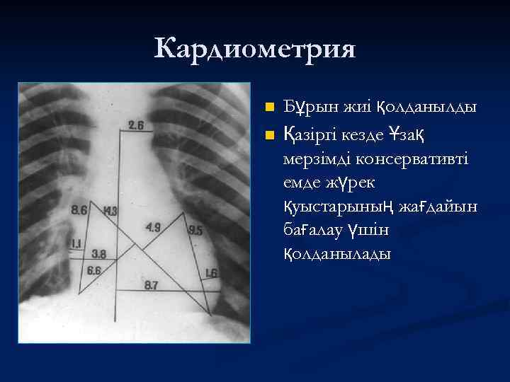 Кардиометрия n n Бұрын жиі қолданылды Қазіргі кезде Ұзақ мерзімді консервативті емде жүрек қуыстарының