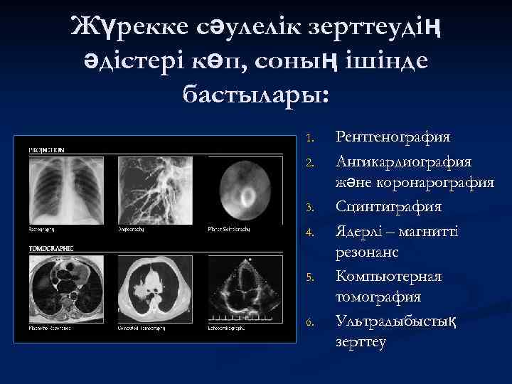 Жүрекке сәулелік зерттеудің әдістері көп, соның ішінде бастылары: 1. 2. 3. 4. 5. 6.