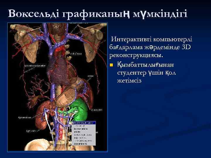 Воксельді графиканың мүмкіндігі Интерактивті компьютерлі бағдарлама жәрдемінде 3 D реконструкциясы. n Қымбаттылығынан студентер үшін