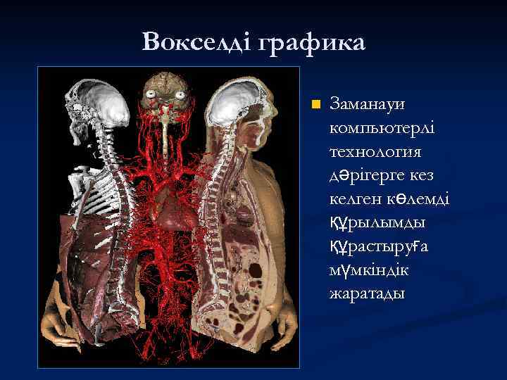 Вокселді графика n Заманауи компьютерлі технология дәрігерге кез келген көлемді құрылымды құрастыруға мүмкіндік жаратады