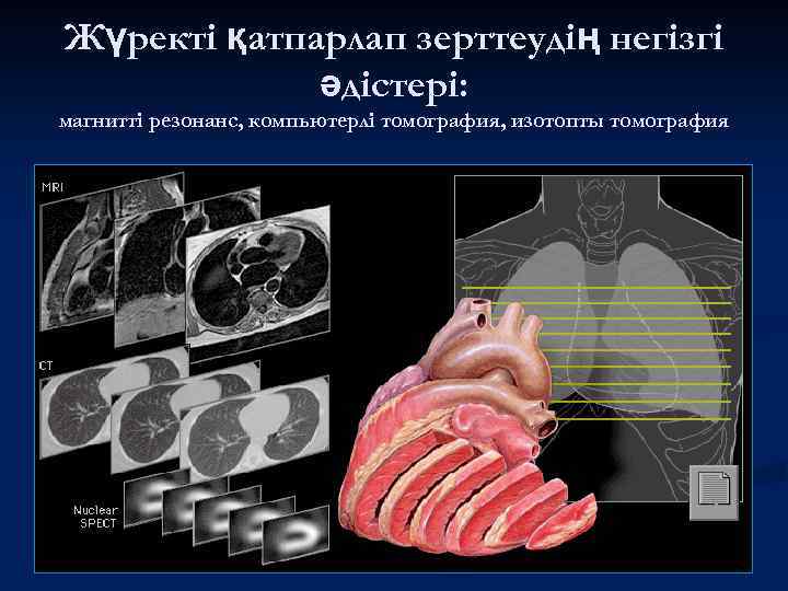 Жүректі қатпарлап зерттеудің негізгі әдістері: магнитті резонанс, компьютерлі томография, изотопты томография 