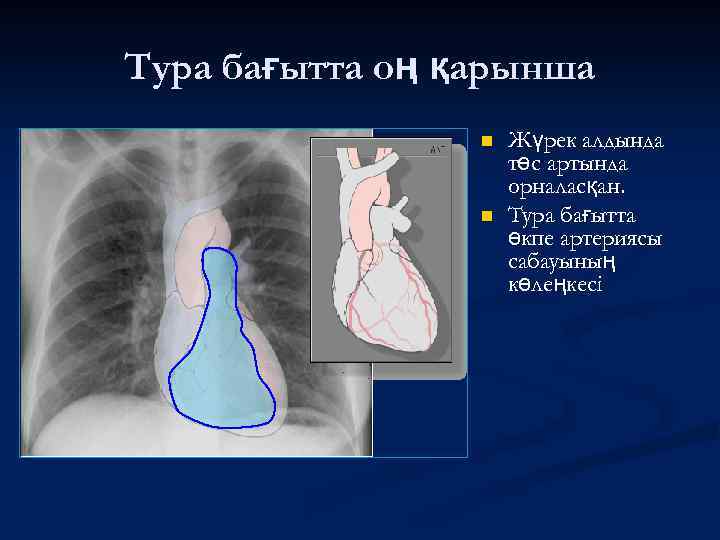 Тура бағытта оң қарынша n n Жүрек алдында төс артында орналасқан. Тура бағытта өкпе