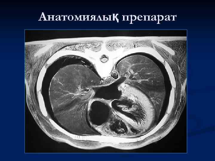 Анатомиялық препарат 