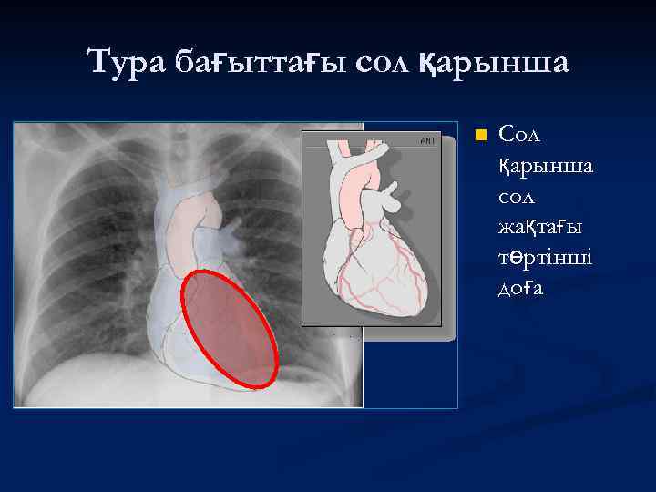 Тура бағыттағы сол қарынша n Сол қарынша сол жақтағы төртінші доға 