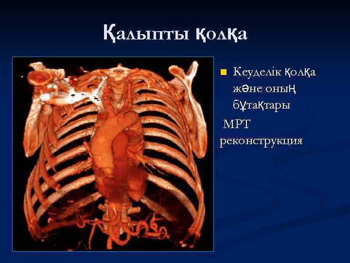Қалыпты қолқа Кеуделік қолқа және оның бұтақтары МРТ реконструкция n 