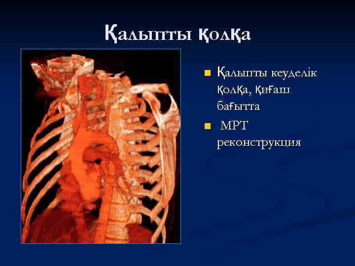 Қалыпты қолқа n n Қалыпты кеуделік қолқа, қиғаш бағытта МРТ реконструкция 