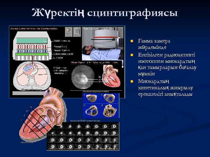 Жүректің сцинтиграфиясы n n n Гамма камера жәрдемінде Енгізілген радиоактивті изотоппен миокардтың қан тамырларын