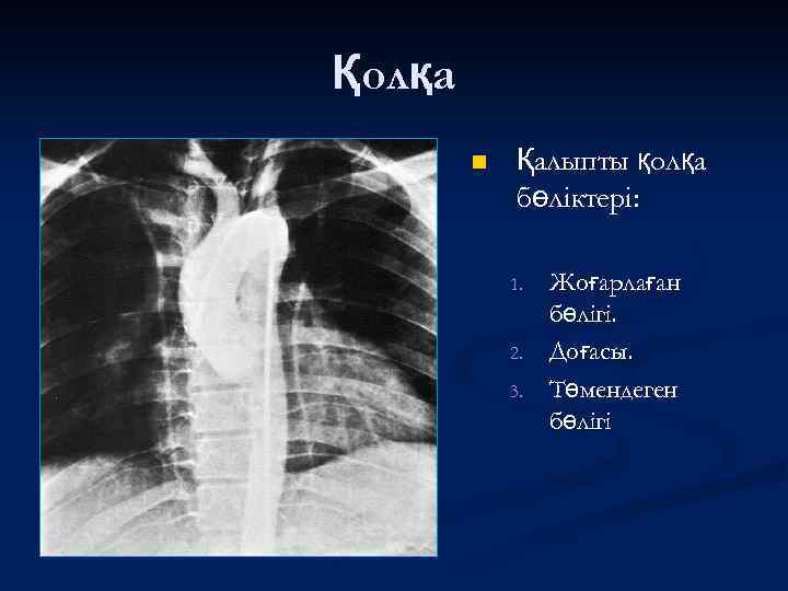 Қолқа n Қалыпты қолқа бөліктері: 1. 2. 3. Жоғарлаған бөлігі. Доғасы. Төмендеген бөлігі 