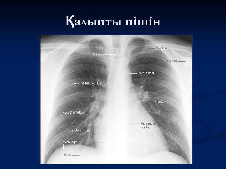 Қалыпты пішін 