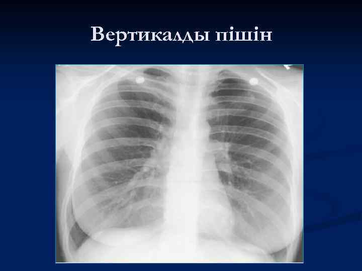 Вертикалды пішін 