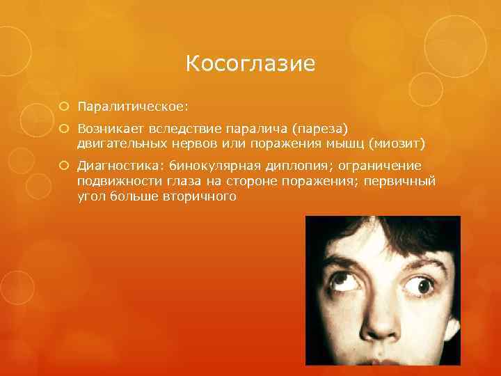 Косоглазие Паралитическое: Возникает вследствие паралича (пареза) двигательных нервов или поражения мышц (миозит) Диагностика: бинокулярная