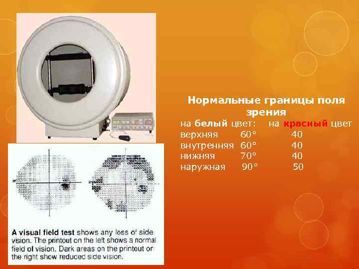 Нормальные границы поля зрения на белый цвет: верхняя 60° внутренняя 60° нижняя 70° наружная