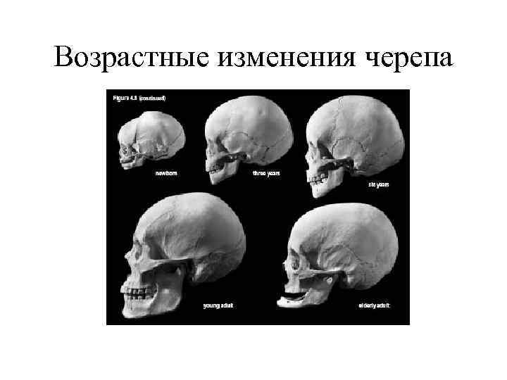 Возрастные изменения черепа 