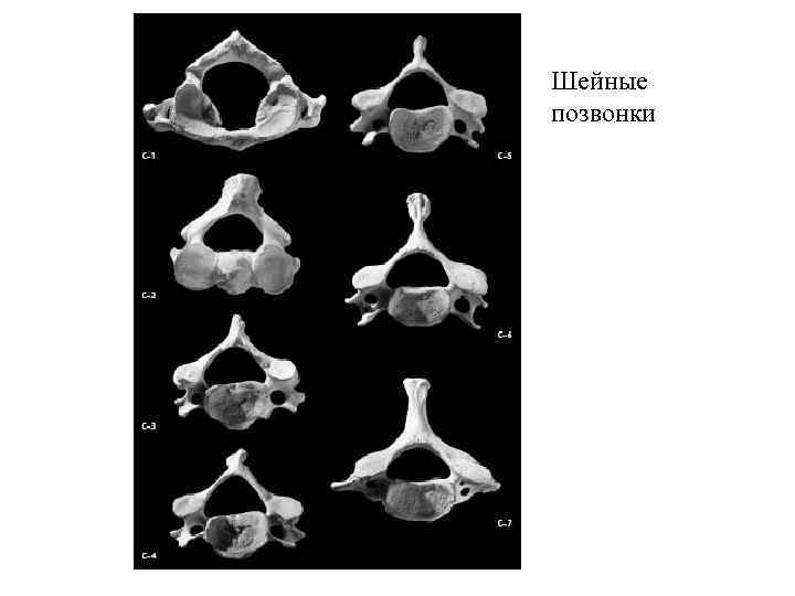 Шейные позвонки 