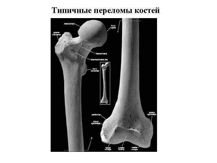 Кости линя. Схема трубчатой кости взрослого и ребенка. Рентген трубчатых костей. Схема длинной трубчатой кости ребенка.