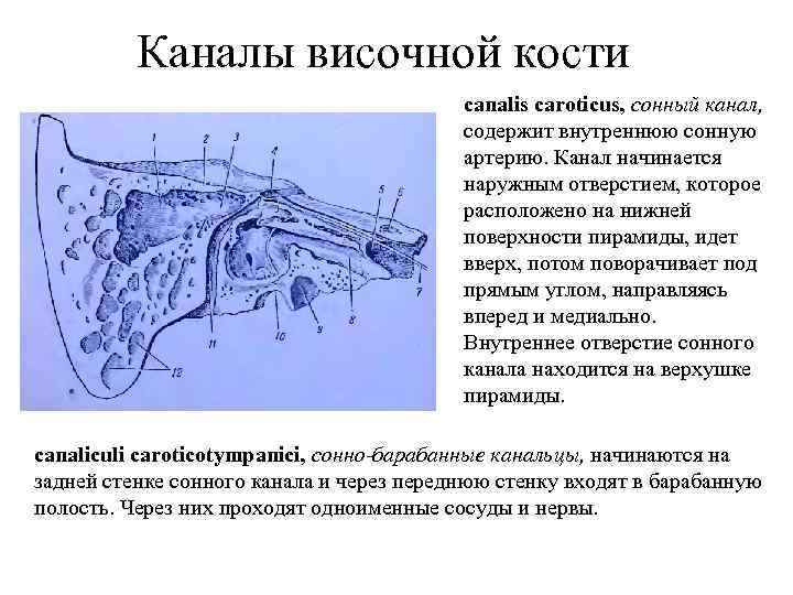 Каналы височной кости canalis caroticus, сонный канал, содержит внутреннюю сонную артерию. Канал начинается наружным