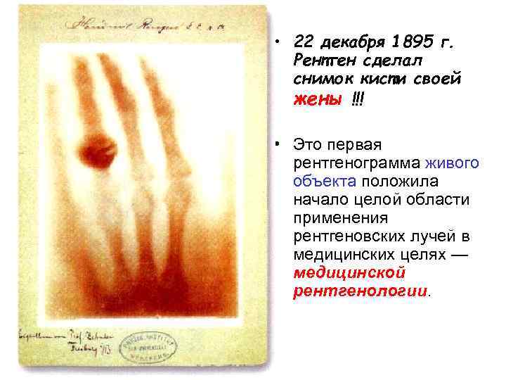  • 22 декабря 1895 г. Рентген сделал снимок кисти своей жены !!! •