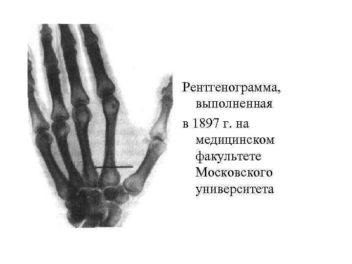 Рентгенограмма, выполненная в 1897 г. на медицинском факультете Московского университета 