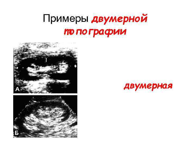 Примеры двумерной топографии двумерная 