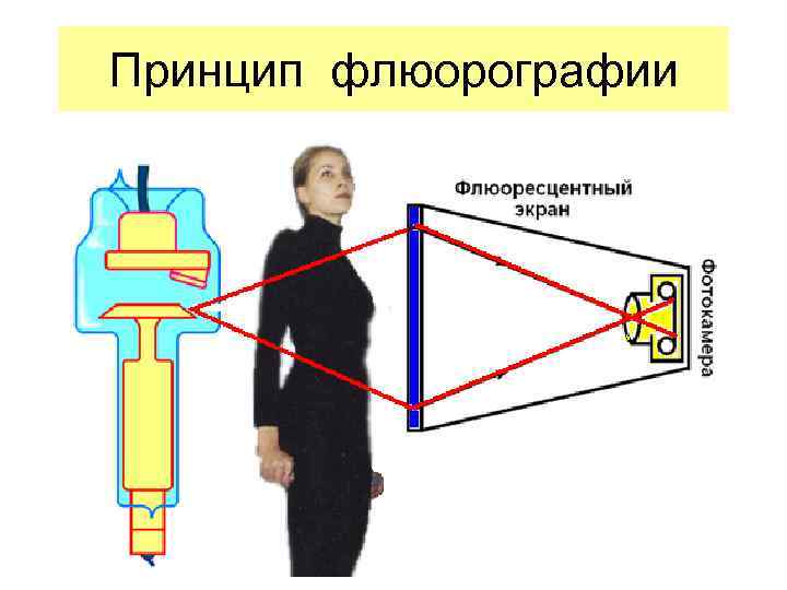 Аппарат для флюорографии фото