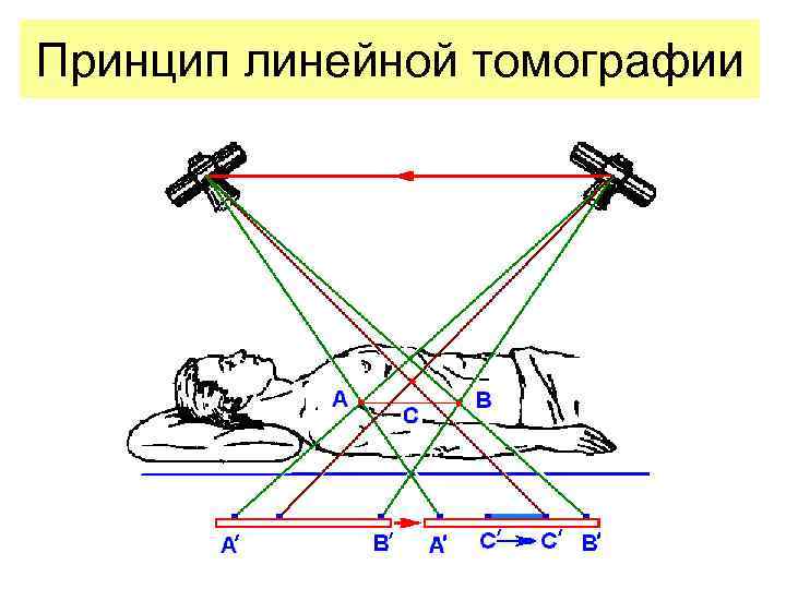 Принцип получения изображения