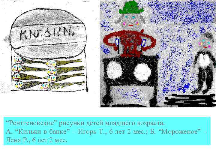 “Рентгеновские” рисунки детей младшего возраста. А. “Кильки в банке” – Игорь Т. , 6
