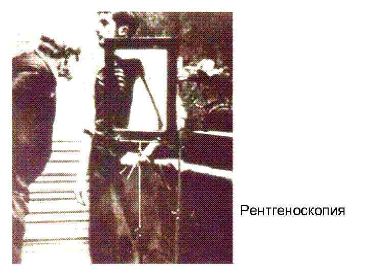 Рентгеноскопия 
