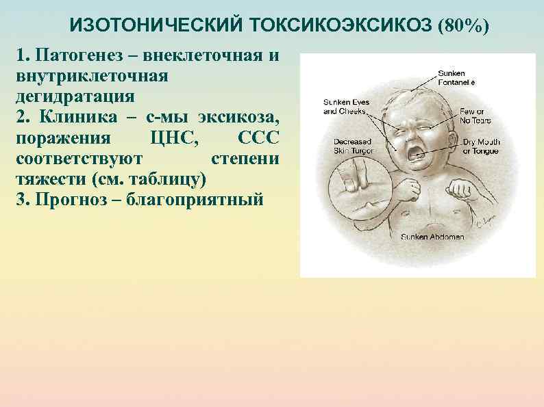 ИЗОТОНИЧЕСКИЙ ТОКСИКОЭКСИКОЗ (80%) 1. Патогенез – внеклеточная и внутриклеточная дегидратация 2. Клиника – с-мы