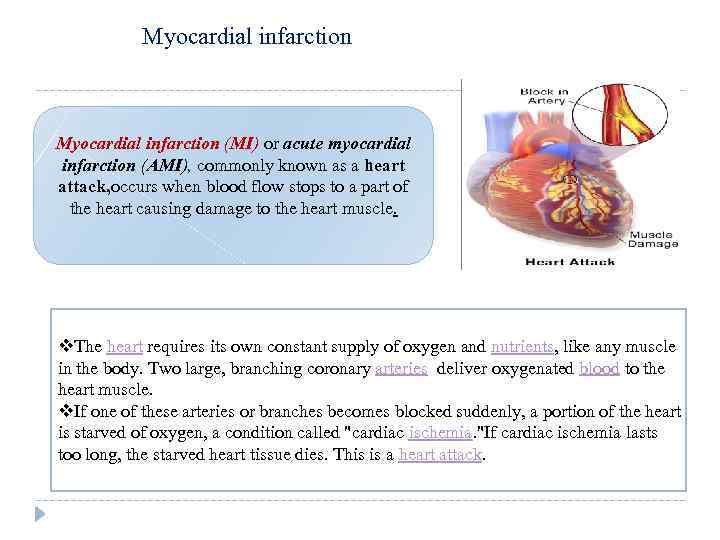 Myocardial infarction (MI) or acute myocardial infarction (AMI), commonly known as a heart attack,