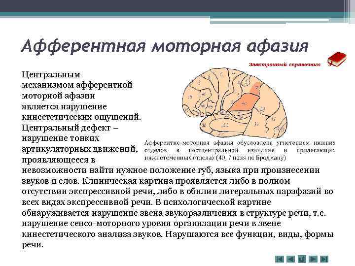 Афферентная моторная афазия симптомы