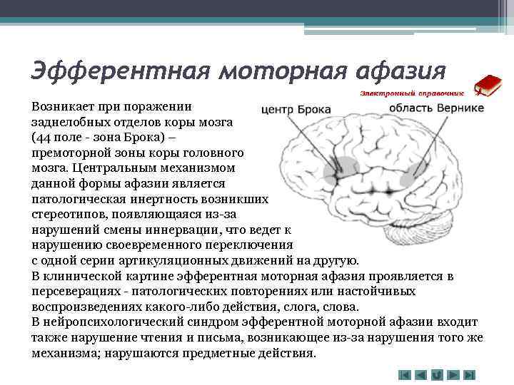 Афферентная моторная афазия симптомы