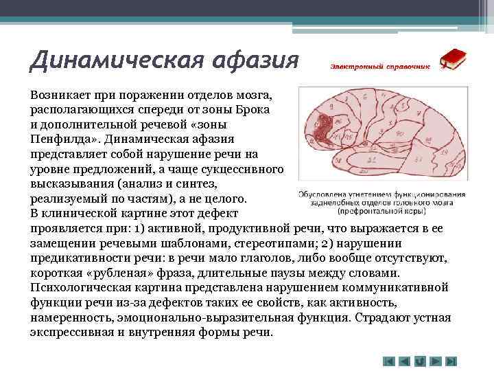 Динамическая афазия Возникает при поражении отделов мозга, располагающихся спереди от зоны Брока и дополнительной