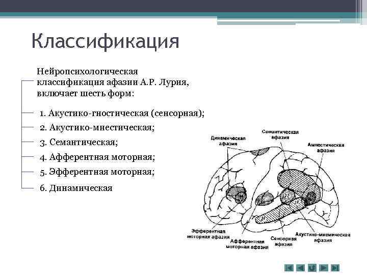 Классификация Нейропсихологическая классификация афазии А. Р. Лурия, включает шесть форм: 1. Акустико-гностическая (сенсорная); 2.